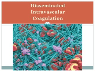 Disseminated
Intravascular
Coagulation
 