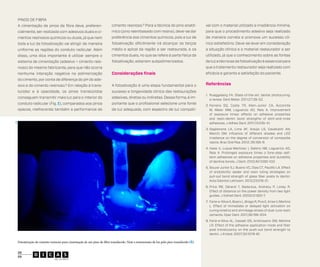 Pinos de fibra	
A cimentação de pinos de fibra deve, preferen-

cimento resinoso.8 Para a técnica do pino anatô-

vel com o material utilizado e irradiância mínima,

cialmente, ser realizada com adesivos duais e ci-

mico (pino reembasado com resina), deve-se dar

para que o procedimento adesivo seja realizado

mentos resinosos químicos ou duais, já que nem

preferência aos cimentos químicos, pois a luz de

de maneira correta e promova um sucesso clí-

toda a luz de fotoativação vai atingir de maneira

fotoativação dificilmente irá alcançar os terços

nico satisfatório. Deve-se levar em consideração

uniforme as regiões do conduto radicular. Além

médio e apical da região a ser restaurada, e os

a situação clínica e o material restaurador a ser

disso, uma dica importante é utilizar sempre o

cimentos duais, no que se refere à parte física da

utilizado, já que o conhecimento sobre as fontes

sistema de cimentação (adesivo + cimento resi-

fotoativação, estariam subpolimerizados.

de luz e técnicas de fotoativação é essencial para
que o tratamento restaurador seja realizado com

noso) do mesmo fabricante, para que não ocorra

Considerações finais

eficácia e garanta a satisfação do paciente.

sivo e do cimento resinoso.8 Em relação à trans-

A fotoativação é uma etapa fundamental para o

Referências

lucidez e à opacidade, os pinos translúcidos

sucesso e longevidade clínica das restaurações

conseguem transmitir mais luz para o interior do

adesivas, diretas ou indiretas. Dessa forma, é im-

conduto radicular (Fig. E), comparados aos pinos

portante que o profissional selecione uma fonte

opacos, melhorando também a performance do

de luz adequada, com espectro de luz compatí-

nenhuma interação negativa na polimerização
do cimento, por conta de diferença do pH do ade-

E

1.	 Rueggeberg FA. State-of-the-art: dental photocuring:
a review. Dent Mater. 2011;27:39-52.
2.	Ferreira SQ, Costa TR, Klein-Júnior CA, Accorinte
M, Meier MM, Loguercio AD, Reis A. Improvement
of exposure times: effects on adhesive properties
and resin-dentin bond strengths of etch-and-rinse
adhesives. J Adhes Dent. 2011;13:235-41.
3.	Gaglianone LA, Lima AF, Araújo LS, Cavalcanti AN,
Marchi GM. Influence of different shades and LED
irradiance on the degree of conversion of composite
resins. Braz Oral Res. 2012; 26:165-9.
4.	Hass V, Luque-Martinez I, Sabino NB, Loguercio AD,
Reis A. Prolonged exposure times o fone-step selfetch adhesives on adhesive properties and durability
of dentine bonds. J Dent. 2012;40:1090-102.
5.	Souza-Junior EJ, Bueno VC, Dias CT, Paulillo LA. Effect
of endodontic sealer and resin luting strategies on
pull-out bond strength of glass fiber posts to dentin.
Acta Odontol Latinoam. 2012;23:216-21.
6.	Price RB, Dérand T, Sedarous, Andreou P, Loney R.
Effect of distance on the power density from two light
guides. J Esthet Dent. 2000;12:320-7.
7.	 Faria-e-Silva A, Boaro L, Braga R, Piva E, Arias V, Martins
L. Effect of immediate or delayed light activation on
curing kinetics and shrinkage stress of dual-cure resin
cements. Oper Dent. 2011;36:196-204.
8.	Faria-e-Silva AL, Casseli DS, Ambrosano GM, Martins
LR. Effect of the adhesive application mode and fiber
post translucency on the push-out bond strength to
dentin. J Endod. 2007;33:1078-81.

Fotoativação de cimento resinoso para cimentação de um pino de fibra translúcido. Note a transmissão de luz pelo pino translúcido (B).
28
29

v.2, n.2, 2013

 