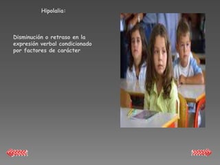 Hipolalia:



Disminución o retraso en la
expresión verbal condicionado
por factores de carácter
 