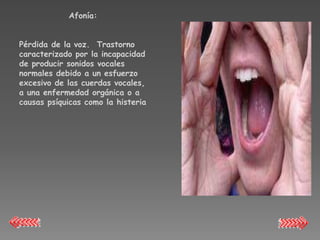 Afonía:


Pérdida de la voz. Trastorno
caracterizado por la incapacidad
de producir sonidos vocales
normales debido a un esfuerzo
excesivo de las cuerdas vocales,
a una enfermedad orgánica o a
causas psíquicas como la histeria
 