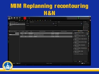 MIM Replanning recontouring
H&N

 
