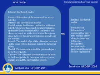 Anal cancer

Eendometrial and cervical cancer

Internal iliac lymph nodes
Cranial: Bifurcation of the common iliac artery
into the
external and internal iliac arteries
Caudal: where the fibers of the levator ani insert
into the obturator fascia and obturator internus,
and can be demarcated either at the level of the
obturator canal, or at the level where there is no
space between the obturator internus muscle and
the midline.
Lateral: The medial edge of the obturator internus
in the lower pelvis; iliopsoas muscle in the upper
pelvis.
Medial: The mesorectum and the presacral space
in the lower pelvis .
Anterior: The obturator internus muscle or bone
in the lower pelvis. In the upper pelvis, a 7-mm
margin around the internal iliac vessels

Michael et al IJROBP 2011

Internal iliac lymph
nodes

VS

From level of
bifurcation of
common iliac artery
into internal artery,
along its branches
(obturator,
hypogastric)
terminating in
paravaginal tissues at
level of vaginal cuff

Small et al IJROBP 2008

 
