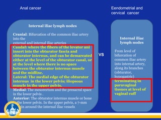 Anal cancer

Eendometrial and
cervical cancer

Internal iliac lymph nodes
Cranial: Bifurcation of the common iliac artery
into the
external and internal iliac arteries
Caudal: where the fibers of the levator ani
insert into the obturator fascia and
obturator internus, and can be demarcated
either at the level of the obturator canal, or
at the level where there is no space
between the obturator internus muscle
and the midline.
Lateral: The medial edge of the obturator
internus in the lower pelvis; iliopsoas
muscle in the upper pelvis.
Medial: The mesorectum and the presacral space
in the lower pelvis .
Anterior: The obturator internus muscle or bone
in the lower pelvis. In the upper pelvis, a 7-mm
margin around the internal iliac vessels

Internal iliac
lymph nodes

VS

From level of
bifurcation of
common iliac artery
into internal artery,
along its branches
(obturator,
hypogastric)
terminating in
paravaginal
tissues at level of
vaginal cuff

 