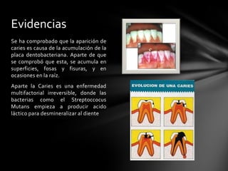 Evidencias
Se ha comprobado que la aparición de
caries es causa de la acumulación de la
placa dentobacteriana. Aparte de que
se comprobó que esta, se acumula en
superficies, fosas y fisuras, y en
ocasiones en la raíz.
Aparte la Caries es una enfermedad
multifactorial irreversible, donde las
bacterias como el Streptoccocus
Mutans empieza a producir acido
láctico para desmineralizar al diente
 
