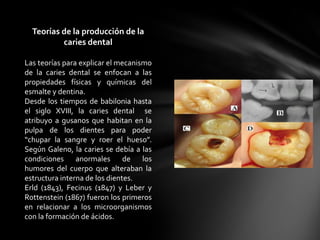 Teorías de la producción de la
          caries dental

Las teorías para explicar el mecanismo
de la caries dental se enfocan a las
propiedades físicas y químicas del
esmalte y dentina.
Desde los tiempos de babilonia hasta
el siglo XVIII, la caries dental se
atribuyo a gusanos que habitan en la
pulpa de los dientes para poder
“chupar la sangre y roer el hueso”.
Según Galeno, la caries se debía a las
condiciones anormales de los
humores del cuerpo que alteraban la
estructura interna de los dientes.
Erld (1843), Fecinus (1847) y Leber y
Rottenstein (1867) fueron los primeros
en relacionar a los microorganismos
con la formación de ácidos.
 