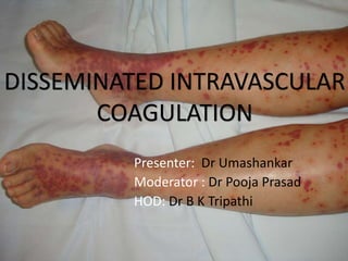 Presenter: Dr Umashankar
Moderator : Dr Pooja Prasad
HOD: Dr B K Tripathi
DISSEMINATED INTRAVASCULAR
COAGULATION
 