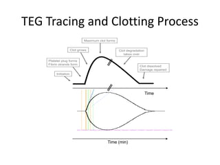 TEG Tracing and Clotting Process
Time (min)
Initiation
Platelet plug forms
Fibrin strands form
Clot grows
Maximum clot forms
Clot degradation
takes over
Clot dissolved
Damage repaired
Time
 