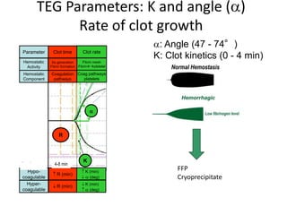 TEG Parameters: K and angle ()
Rate of clot growth
R
Clot time
IIa generation
Fibrin formation
Coagulation
pathways
R
Clot time
IIa generation
Fibrin formation
Coagulation
pathways
Parameter
Hemostatic
Activity
Hemostatic
Component
Hypo-
coagulable
Hyper-
coagulable
 R (min)
 R (min)
 R (min)
 R (min)
 K (min)
 (deg)
 K (min)
 (deg)
 K (min)
 (deg)
 K (min)
 (deg)
Clot rate
Fibrin mesh
Fibrinplatelet
Coag pathways
platelets
K

Clot rate
Fibrin mesh
Fibrinplatelet
Coag pathways
platelets
K

Dysfunction 4-8 min
: Angle (47 - 74°)
K: Clot kinetics (0 - 4 min)
FFP
Cryoprecipitate
 