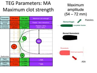 TEG Parameters: MA
Maximum clot strength
R
Clot time
IIa generation
Fibrin formation
Coagulation
pathways
R
Clot time
IIa generation
Fibrin formation
Coagulation
pathways
Parameter
Hemostatic
Activity
Hemostatic
Component
Hypo-
coagulable
Hyper-
coagulable
 R (min)
 R (min)
 R (min)
 R (min)
 K (min)
 (deg)
 K (min)
 (deg)
 K (min)
 (deg)
 K (min)
 (deg)
 MA
 MA
 MA
 MA
Clot rate
Fibrin X-linking
Fibrinplatelet
Coag pathways
platelets
K

Clot rate
Fibrin X-linking
Fibrinplatelet
Coag pathways
platelets
K

Maximum clot strength
Platelet – fibrin interactions
Platelets (~80%)
Fibrin (~20%)
MA
Maximum clot strength
Platelet – fibrin interactions
Platelets (~80%)
Fibrin (~20%)
MA
Dysfunction
Maximum
amplitude
(54 – 72 mm)
Platelets
ASA
 