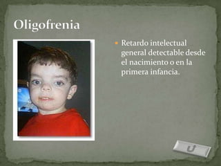  Retardo intelectual
 general detectable desde
 el nacimiento o en la
 primera infancia.
 