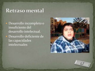  Desarrollo incompleto o
  insuficiente del
  desarrollo intelectual.
 Desarrollo deficiente de
  las capacidades
  intelectuales
 