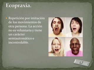  Repetición por imitación
 de los movimientos de
 otra persona. La acción
 no es voluntaria y tiene
 un carácter
 semiautomático e
 incontrolable.
 