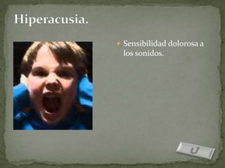  Sensibilidad dolorosa a
 los sonidos.
 