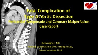 Fatal Complication of 
Type A Aortic Dissection 
Pericardial Tamponade and Coronary Malperfusion 
Case Report 
Dicky Aligheri, MD 
National Cardiovascular Centre Harapan Kita, 
Jakarta Indonesia 2014 
 