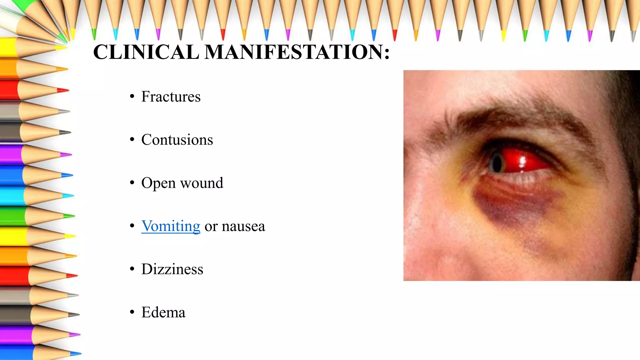 Disseminated intravascular coagulopathy | PPTX