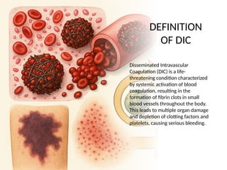 Disseminated Intravascular Coagulation (DIC) Syndrome | PPTX