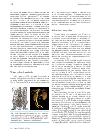 172 A Calzado y J Geleijns
Rev Fis Med 2010;11(3):163-180
para estas aplicaciones. Estos escáneres dentales son
relativamente pequeños y presentan componentes dife-
rentes de los de TC de cuerpo entero45,46. En particular,
los escáneres de CT dental están equipados con un tubo
de rayos X compacto (de una potencia relativamente
baja) y por lo general tienen un detector de panel plano.
El detector de panel plano es comparable a los que
incorporan los equipos de rayos X utilizados para obtener
radiografías digitales de proyección. Los escáneres de TC
dental están diseñados para que el paciente esté sentado
durante el examen. La ventaja de estos equipos es que
proporcionan una calidad de imagen suficiente para
aplicaciones en radiología maxilofacial con coste relativa-
mente bajo. De manera general ofrecen un rendimiento
pobre en lo que respecta a la resolución de bajo contraste,
lo que significa que los tejidos blandos no se pueden eva-
luar adecuadamente en las imágenes reconstruidas. Esto
no supone en general una limitación para su aplicación
clínica en el campo de imagen dental, aunque limita su
potencial de aplicación en otros campos de la imagen
médica. El diseño de los escáneres de TC de haz cónico
dentales impone también una limitación de la velocidad
de rotación del brazo en el que están montados el tubo
de rayos X y el detector. Esto significa que el tiempo de
rotación es relativamente largo. Con los equipos de CBCT
dental se obtienen imágenes de cortes axiales muy finos
de la mandíbula que puede ser reformateadas en múlti-
ples vistas panorámicas y transversales.
TC con realce de contraste
En las imágenes de TC con realce de contraste, se
produce artificialmente contraste entre estructuras que
no serían visibles directamente en las exploraciones
(fig. 9). En angiografía TC se administra contraste yoda-
do por vía intravenosa para mejorar el contraste entre
la luz y la pared del vaso. En algunos estudios de
abdomen antes de la TC se administra por vía oral una
solución diluida de yodo para mejorar el contraste en el
tracto gastrointestinal. En la colonografía TC se introdu-
ce gas a través del recto para mejorar el contraste entre
el colon y los tejidos circundantes.
Aplicaciones especiales
Entre las aplicaciones especiales de la TC se inclu-
ye, por una parte, la planificación del tratamiento de
radioterapia, que es una aplicación ya consolidada; por
otra parte, hay otras aplicaciones más experimentales,
tales como las imágenes de TC de doble energía y los
estudios dinámicos de TC volumétrico. Las imágenes
de TC para la planificación del tratamiento de radiote-
rapia se obtienen explorando al paciente en la posición
que adoptará durante las sesiones de radioterapia. Hay
escáneres especiales (wide bore scanners) con una
abertura del gantry suficientemente grande como para
permitir que el paciente sea explorado en esa posición,
y permiten un gran FOV4.
Las imágenes de TC de doble energía (o energía
dual) requieren adquisiciones del volumen de interés
con dos diferentes energías promedio de fotones, lo
que se efectúa escaneando el volumen de interés
con dos voltajes del tubo. También se puede utilizar
filtración adicional del haz para optimizar más los dos
espectros de rayos X. La TC de energía dual permite
una mejor diferenciación entre ciertos tejidos con y sin
patologías. Se puede diferenciar, por ejemplo, entre el
ácido úrico que contiene cálculos urinarios y el ácido
úrico que no lo contiene. La TC de energía dual permite
mejorar la visualización de los tendones de la mano y el
pie; además, se pueden eliminar las estructuras óseas
de la imagen en las exploraciones angio-TC, lo que es
conveniente antes de interpretar los resultados de algu-
nos estudios47,48.
Algunos escáneres permiten la obtención de estu-
dios dinámicos de TC, esto es, el seguimiento de la
evolución temporal de un proceso dinámico en un
volumen de interés. Estas exploraciones son también
conocidas como TC en 4D. En ellas se puede visualizar,
por ejemplo, el movimiento de las articulaciones o la
captación de contraste en ciertos órganos (perfusión o
angiografía TC dinámica). La fig. 10 muestra un ejemplo
de un estudio de angio-TC dinámica del cerebro con un
escáner de tomografía volumétrica que cubre todo el
cerebro (Aquilion ONE, Toshiba). Con las imágenes de la
evolución temporal del realce de contraste vascular del
cerebro se puede hacer un seguimiento del realce arte-
rial y venoso. Actualmente es posible realizar estudios de
perfusión de órganos tales como el cerebro, el corazón
y el hígado. Durante los estudios dinámicos el operador
Fig. 9. En la colonografía TC se introduce gas a través del
recto para mejorar el contraste entre el colon y los tejidos
circundantes (izquierda). En angiografía TC se administra
contraste yodado por vía intravenosa para mejorar el con-
traste entre la luz y la pared del vaso (derecha).
 