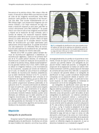 169
Tomografía computarizada. Evolución, principios técnicos y aplicaciones
Rev Fis Med 2010;11(3):163-180
frecuencia en la práctica clínica, filtro sharp o filtro de
hueso. A menudo se utilizan filtros que reducen el nivel
de ruido de las imágenes reconstruidas; estos filtros
producen cierta pérdida de respuesta en las frecuen-
cias más altas. Esto sucede moderadamente con un
filtro Shepp-Logan, que proporciona imágenes que son
menos ruidosas y con mejor resolución de bajo con-
traste y resolución espacial un poco peor; este filtro se
conoce clínicamente como filtro estándar29. Se puede
reducir aún más el ruido en las imágenes reconstruidas
y mejorar así la resolución de bajo contraste, pero a
cambio de obtener una resolución espacial notable-
mente peor; estos filtros son los que en las aplicaciones
clínicas se suelen denominar smooth o filtros de tejido
blando. Los equipos de TC actuales ofrecen muchos
filtros de reconstrucción que están optimizados para
aplicaciones clínicas específicas. Es posible reconstruir
una sola exploración con diferentes filtros de recons-
trucción para optimizar la visualización de, por ejemplo,
tejidos óseos y blandos de manera adecuada.
Además de la FBP, se pueden aplicar también téc-
nicas de reconstrucción algebraicas o estadísticas. La
reconstrucción algebraica, usada en los primeros tiem-
pos de la TC puede parecer atractiva; sin embargo, la
reconstrucción a través de resolución de ecuaciones no
es viable en la práctica clínica, debido fundamentalmen-
te a las grandes matrices (512 x 512; 1024 x 1024) que
se utilizan en imágenes médicas y a las inconsistencias
en las ecuaciones, causadas por errores de medición y
por el ruido. Un desafío de cara al futuro lo constituyen
los métodos de reconstrucción iterativos (estadísticos),
que se están intentando introducir en la TC. La recons-
trucción iterativa es relativamente bien conocida en el
tratamiento de imágenes médicas, ya que se utiliza habi-
tualmente en medicina nuclear30-33. Las técnicas itera-
tivas podrían proporcionar beneficios potenciales en la
aplicación de la TC, incluida la eliminación de artefactos
de rayas (en particular, cuando se utilizan pocos ángulos
de proyección), y un mejor rendimiento en la adquisi-
ción de TC de baja dosis34. Sin embargo, las imágenes
reconstruidas mediante métodos iterativos pueden verse
afectadas por artefactos que no están presentes en las
imágenes reconstruidas con FBP, tales como patrones
de aliasing o valores fuera de rango (overshoots) en áreas
con altos gradientes de intensidad. En los últimos tiem-
pos se están introduciendo algoritmos de reconstrucción
iterativa en los escáneres comerciales.
Adquisición
Radiografía de planificación
El examen real de TC está precedido por al menos una
radiografía plana de planificación. Se efectúa con el tubo
de rayos X estático (sin rotación), con el haz muy colima-
do longitudinalmente y la camilla con el paciente en movi-
miento. El tubo de rayos X se fija por lo general en una
posición que permita obtener una radiografía de pro-
yección frontal o lateral del paciente. La radiografía de
proyección de la exploración se realiza con valores inter-
medios de tensión (120 kV) y valores bajos de intensidad
de corriente del tubo (entre 20 y 100 mA). La exposición
a la radiación del paciente debida a la radiografía de
planificación es baja y puede considerare despreciable
comparada con la exposición debida al examen com-
pleto de TC. La calidad de imagen, en particular la reso-
lución espacial, de estas radiografías es moderada en
comparación con la de las radiografías clínicas.
Las radiografías de planificación sirven para fijar las
posiciones de inicio y finalización de la adquisición de TC.
Algunos sistemas automáticos de control de la exposición
en TC obtienen la información sobre la transmisión de
diferentes zonas del paciente a partir del análisis de la(s)
radiografía(s) de planificación. Los sistemas automáticos
de control de la exposición estiman a continuación la
corriente óptima del tubo en función de la posición longi-
tudinal del tubo de rayos X relativa al paciente; esos valo-
res de corriente serán los aplicados durante la adquisición
de TC; esto se llama modulación de la corriente del tubo
en el eje z. La fig. 5 muestra la adaptación de la carga
del tubo (mAs) por el control automático de exposición
en cuatro posiciones diferentes; durante la adquisición
helicoidal la carga del tubo es mayor en zonas con alta
atenuación y disminuye en las zonas con menor atenua-
ción de los rayos X. El control automático de la exposición
en TC también puede compensar las diferencias de ate-
nuación en diferentes ángulos de proyección, lo que se
denomina modulación x-y o modulación angular35.
75mAs
55mAs
45mAs
75mAs
Fig. 5. La radiografía de planificación sirve para preseleccionar
los valores de mAs de los sistemas de modulación automáti-
ca en función de la atenuación. Se muestra la adaptación de
la carga del tubo (mAs) por el control automático de exposi-
ción en cuatro posiciones diferentes.
 