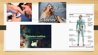 Diabetes 