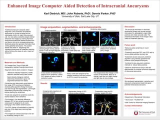 Enhanced Image Computer Aided Detection of Intracranial Aneurysms
                                                         Karl Diedrich, MS ; John Roberts, PhD ; Dennis Parker, PhD
                                                                                           1                                     1                                       1
                                                                                      1
                                                                                       University of Utah, Salt Lake City, UT



Introduction                                        Image acquisition, segmentation, and enhancements.                                                                         Discussion
Traditional aneurysm computer aided                                                                                               Centerline determination                      The structural information in the three
                                                           Image acquisition              Artery segmentation
diagnosis (CAD) schemes call potential                                                                                                                                         dimensional image may provide enough
aneurysms by circling the area and the                                                                                                                                         information for radiologists to reject false
radiologists confirm or reject the aneurysm                                                                                                                                    positives and make accurate calls. The
call. Our new artery centerline based method                                                                                                                                   anatomical information in the image is also
enhances the images by coloring the three                                                                                                                                      useful for treatment planning.
dimensional anatomical shaded surface from
cool blue to hot red by increasing aneurysm
likelihood giving finer grained information than
circling potential aneurysms. The system                                                                                                                                       Future work
assists the viewer in diagnosing and               Maximum Intensity Projection       Projection of arteries         Distance from edge (DFE) Centerlines are red in a
                                                                                                                                                                               •Reducing extra centerlines in round
visualizing aneurysms for treatment planning       showing Bright moving arterial     segmented by finding           cross section. Higher    distance from centerline
                                                                                                                                                                               aneurysms
without forcing the viewer to call or reject an    blood in Time of Flight Magnetic   smoothest Z-buffer seed and    hotter middle values     (DFC) image.
aneurysm.                                          Resonance Angiogram.               region growing.                become centerlines.                                       •Threshold using high DFC over DFE ratio to
                                                                                                                                                                               remove false positives at artery tips.
                                                                                                                                                                               •Implement second aneurysm prediction
                                                                                                                                                                               algorithm using intensity gradients that
                                                                                                                                                                               enhance round shaped aneurysms.
Materials and Methods                                                                                                                                                          •Combine the two aneurysm prediction
•3-D images from Time of Flight MR                                                                                                                                             methods to reduce false positives.
Angiography highlight flowing arterial blood.                                                   Assignment                                                                     •Observer performance study to test the
                                                                                                banding                                                                        effectiveness of computer enhanced diagnosis
•Segment arteries (tools created in ImageJ)
                                                                                                                                                                               of intracranial aneurysms.
  – Maximum Intensity Projection Z-buffer            Cross section of centerline and                                                   This image shows the change in DFE
                                                                                               Artery voxels are assigned to the
   algorithm identifies artery seed voxels.          distance from centerline. Lowest                                                  (radius) of the arteries. Black is no
                                                                                               nearest centerline voxel and colored
  – Seed intensity histogram method                  DFC assigns all artery voxels to                                                  change, dark blue is a slight change
                                                                                               by DFE to match the centerline.
    determines thresholds to grow 3-D                centerline voxels.                                                                and light blue is more change.          Conclusion
    segmented arteries from seeds.                                                                                                                                             We developed segmentation, centerline and
•Centerlines are determined using distance          Results                                                                                                                    aneurysm enhancement tools that signal
                                                                    Subjects               Aneurysms             Detected             Sensitivity            False Positives
from edge (DFE) scoring and Dijkstra's                                                                           aneurysms                                   per subject       potential intracranial aneurysms.
shortest paths algorithm finding the lowest                         8                      9                     9                    1.0                    3.875
cost line through the segmentation. Line length
thresholding removes lines crossing the                 Unsegmented projections of               Segmented change in DFE                 Thresholding: keep top 8%
arteries leaving the centerlines.                       aneurysm subjects.                       colored surface shading.               intensity, largest 20% size.
•Voxels are assigned to centerline voxels by                                                                                                                                   Acknowledgements
nearest distance from centerline.                                                                                                                                              •Department of Biomedical Informatics
•The change in the absolute difference                                                                                                                                         • NLM Grant: T15LM007124
between DFE of two centerline points eight
voxels apart is assigned to all voxels                                                                                                                                         •Utah Center for Advanced Imaging Research
belonging to the middle centerline point.
                                                                                                                                                                               Contact Information
•The DFE change is thresholded by intensity
and size of the signal spot reducing false                                                                                               2 mm                       7 mm
                                                                                                                                                                               Karl.Diedrich@utah.edu
positives.                                                                                                                               aneurysm                   aneurysm

•The images are colored cool blue to hot red
by increasing change in DFE.
 