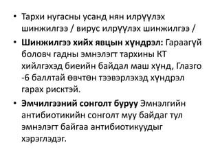 • Тархи нугасны усанд нян илрүүлэх
шинжилгээ / вирус илрүүлэх шинжилгээ /
• Шинжилгээ хийх явцын хүндрэл: Гараагүй
боловч гадны эмнэлэгт тархины КТ
хийлгэхэд биеийн байдал маш хүнд, Глазго
-6 баллтай өвчтөн тээвэрлэхэд хүндрэл
гарах рисктэй.
• Эмчилгээний сонголт буруу Эмнэлгийн
антибиотикийн сонголт муу байдаг тул
эмнэлэгт байгаа антибиотикуудыг
хэрэглэдэг.

 