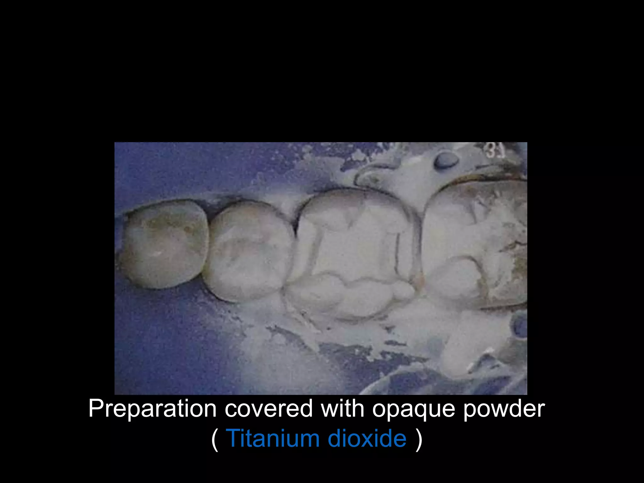 Preparation covered with opaque powder
( Titanium dioxide )
 