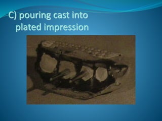 C) pouring cast into
plated impression
 