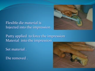 Flexible die material is
Injected into the impression .
Putty applied to force the impression
Material into the impression
Set material .
Die removed .
 