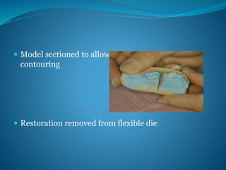  Model sectioned to allow proximal access for
contouring
 Restoration removed from flexible die
 