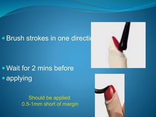  Brush strokes in one direction
 Wait for 2 mins before
 applying
Should be applied
0.5-1mm short of margin
 