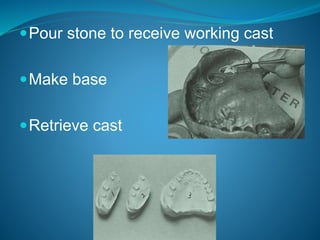 Pour stone to receive working cast
Make base
Retrieve cast
 