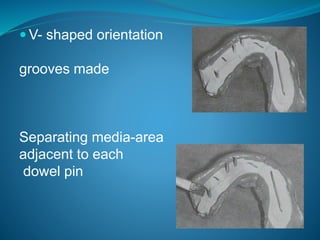  V- shaped orientation
grooves made
Separating media-area
adjacent to each
dowel pin
 