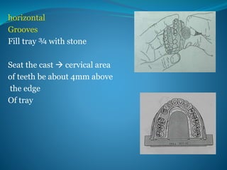 horizontal
Grooves
Fill tray ¾ with stone
Seat the cast  cervical area
of teeth be about 4mm above
the edge
Of tray
 