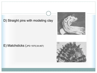 D) Straight pins with modeling clay
E) Matchsticks (JPD 1975;34;467)
 