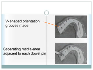 V- shaped orientation
grooves made
Separating media-area
adjacent to each dowel pin
 