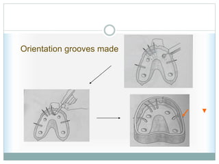 Orientation grooves made
 