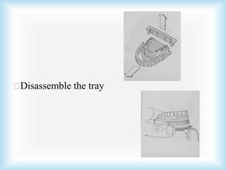 Disassemble the tray
 
