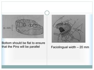 Bottom should be flat to ensure
that the Pins will be parallel Faciolingual width – 20 mm
 