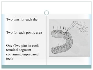 Two pins for each die
Two for each pontic area
One /Two pins in each
terminal segment
containing unprepared
teeth
 