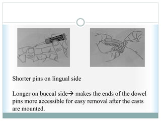 Shorter pins on lingual side
Longer on buccal side makes the ends of the dowel
pins more accessible for easy removal after the casts
are mounted.
 