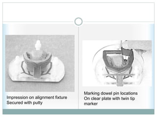 Impression on alignment fixture
Secured with putty
Marking dowel pin locations
On clear plate with twin tip
marker
 