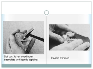 Set cast is removed from
baseplate with gentle tapping
Cast is trimmed
 