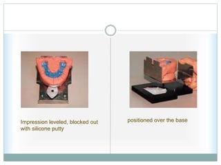 Impression leveled, blocked out
with silicone putty
positioned over the base
 