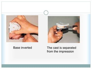 Base inverted The cast is separated
from the impression
 