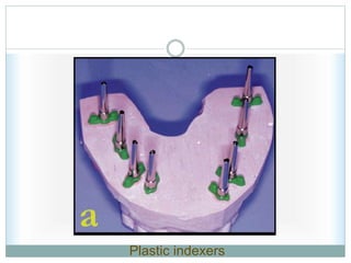 Plastic indexers
 