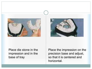 Place the impression on the
precision base and adjust,
so that it is centered and
horizontal.
Place die stone in the
impression and in the
base of tray
 