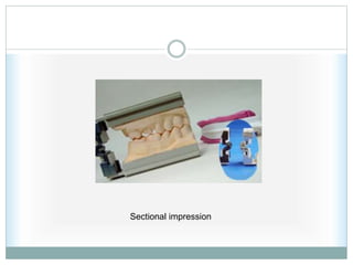 Sectional impression
 