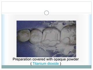 Preparation covered with opaque powder
( Titanium dioxide )
 