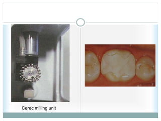 Cerec milling unit
 
