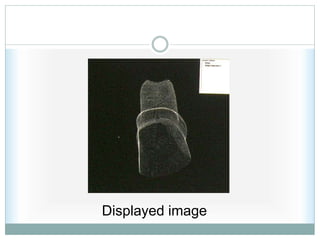 Displayed image
 
